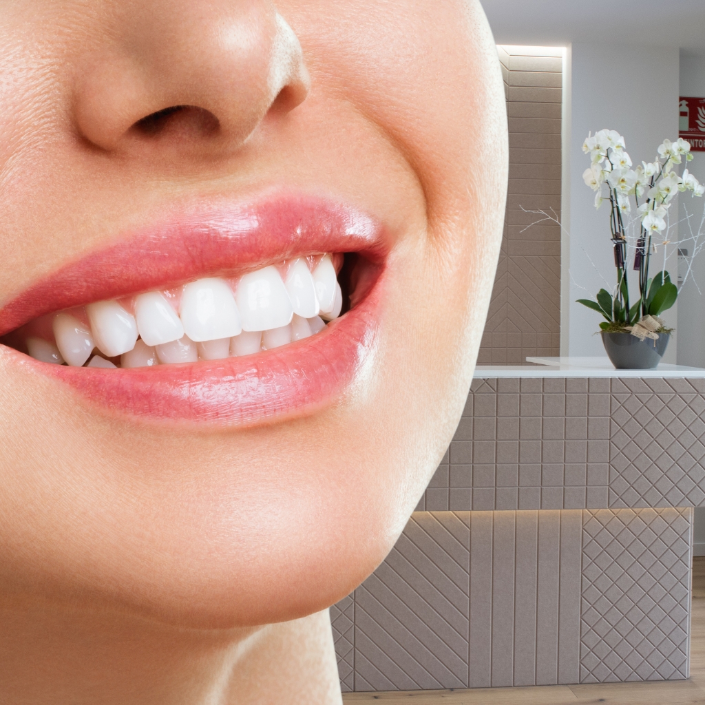Sonrisa después de un tratamiento de carillas dentales en Ontinyent