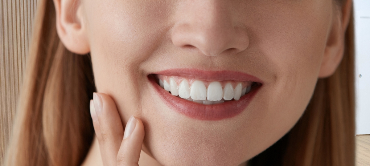 Sonrisa tras un blanqueamiento dental profesional en Ontinyent