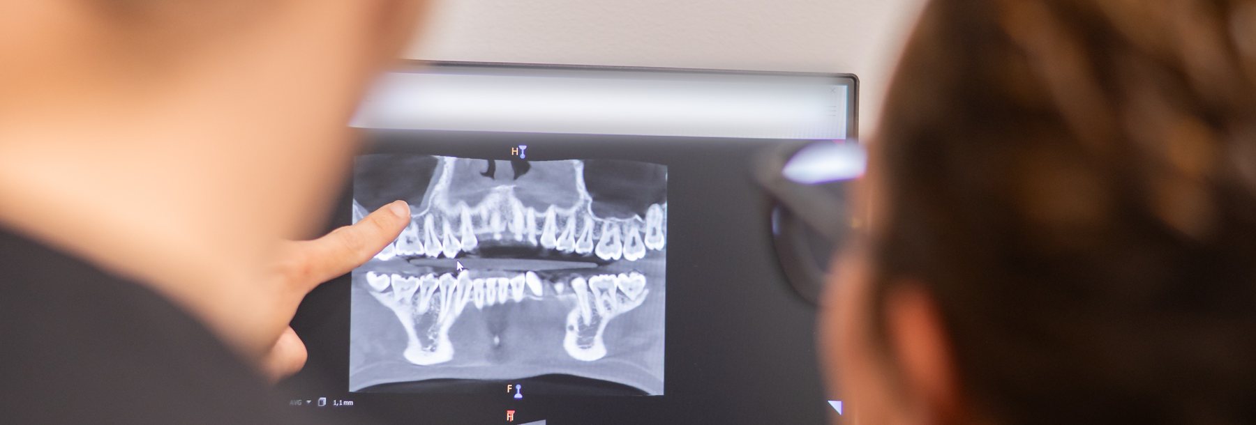 Planificacion de protesis dental sobre escaner 3D en la clinica de Ontinyent